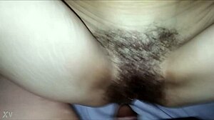 Chatting casually about a hairy situation