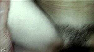 Chatting casually about a hairy situation