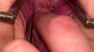 Watch the fist queen get her pussy stretched with a metal ring in this extreme session!