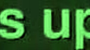 Amateur Nurse Patient Anal Fisting Training Domination in Hospital Gloves