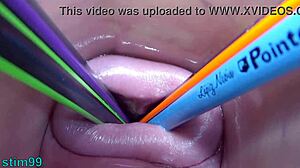 Prolapsed cervix lesbians at the same time